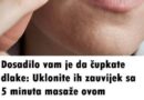 DOSADILO VAM JE DA ČUPATE DLAKE – UKLONITE IH ZAUVIJEK SA 5 MINUTA MASAŽE OVE SMJESOM