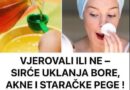 Vjerovali ili ne – sirće se može riješiti bora, akni i staračkih pjega