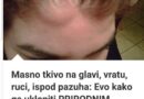 MASNO TKIVO NA VRATU, ISPOD PAZUHA, RUCI EVO KAKO GA UKLONITI