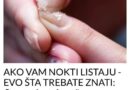 AKO VAM NOKTI LISTAJU – EVO ŠTA TREBATE ZNATI: Ovo nedostaje vašem organizmu!