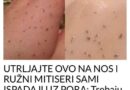 UTRLJAJTE OVO NA NOS I RUŽNI MITISERI ĆE SAMI ISPASTI: Trebaju vam samo 2 sastojka, a imate ih kući!