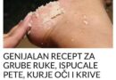 GENIJALAN RECEPT ZA GRUBE RUKE, ISPUCALE PETE, KURJE OČI I KRIVE NOKTE NA NOGAMA: Obavezno zapišite, nećete se pokajati