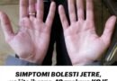 SIMPTOMI BOLESTI JETRE, uočite ih rano: 10 znakova KOJE VAM ŠALJE VAŠE TIJELO