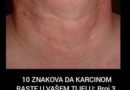 Najbolji prirodni lekovi protiv osteoporoze za jačanje kostiju!